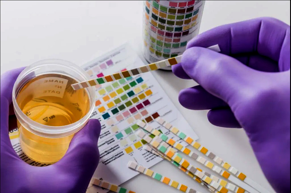 Urine Test Strip